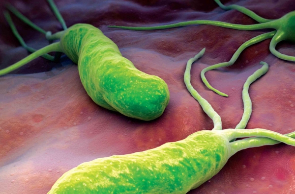 Anticorpi anti Helicobacter pylori. Utilità clinica della ricerca degli anticorpi anti Helicobacter pylori